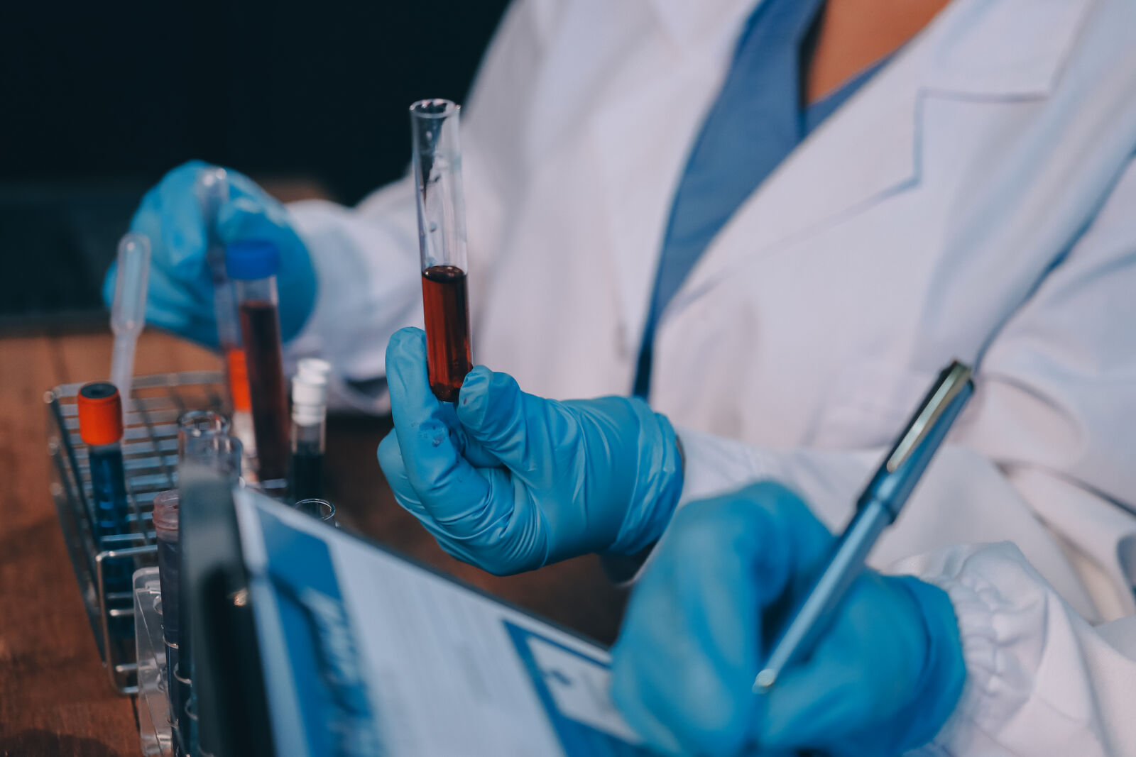 Kako revolucionarni test krvi otkriva pedeset različitih vrsta kancera