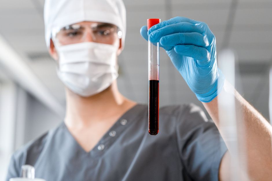 Revolucionarni test krvi: Novi uvid u mikrookruženje tumora za precizniju dijagnostiku raka